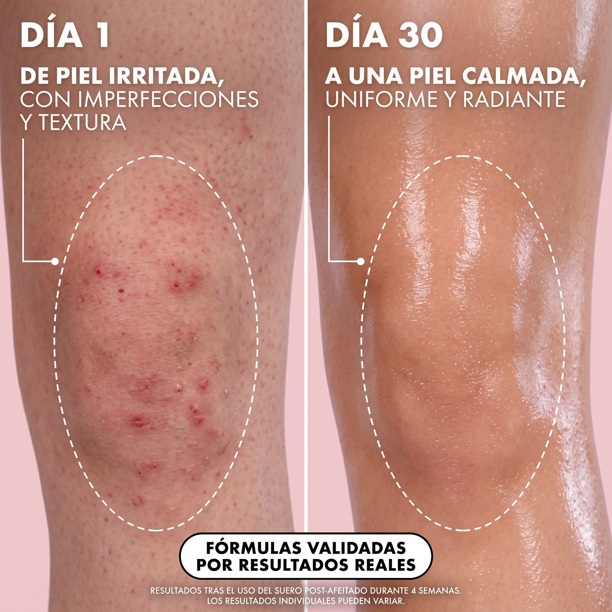 Comparativa de la piel antes y después de cuatro semanas de uso
